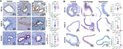 Extrahepatic Bile Duct Organoids as a Model to Study Ischemia/Reperfusion Injury During Liver Transplantation